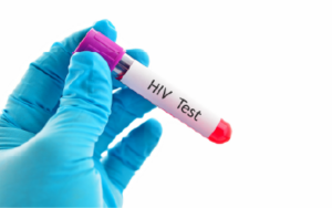 Vial with text HIV test